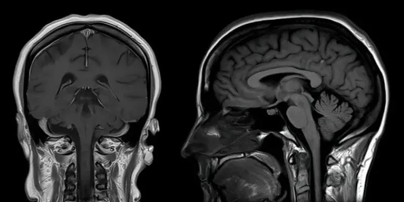Image showcasing cGAN application