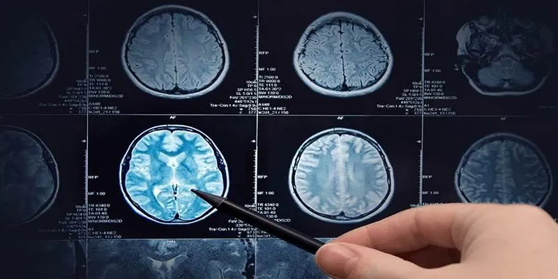 AI in Cancer Research